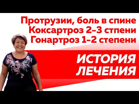 Артроз коленных и тазобедренных суставов. Боль в спине и голеностопе. История лечения