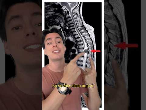 PESQUISADORES BRASILEIROS DESENVOLVEM MEDICAMENTO QUE REVERTER LESÕES NA MEDULA ⚠️