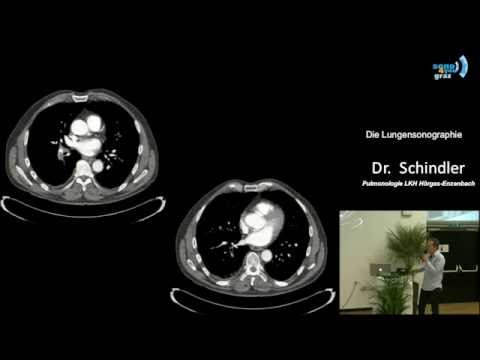 Zu welchem Arzt bei Schmerzen in den Gelenken einschreiben Gelenke knirschen nach der Schwangerschaft