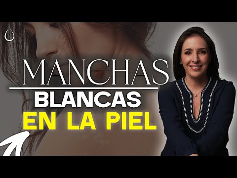 White Spots On The Skin: Causes And Solutions @drapilarochoa - Dermatologist