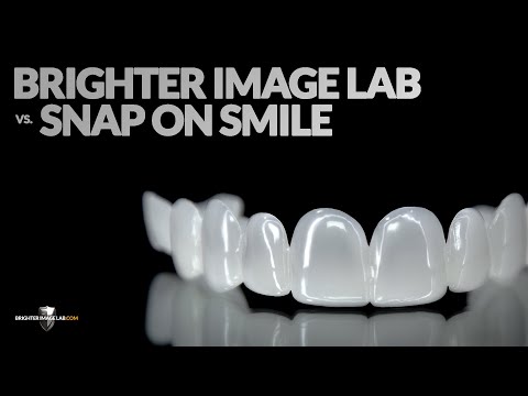 Snap-On Smile-Kosten im Brighter Image Lab!Wir werden den Preis ihres Zahnarztes um 50% übertreffen!