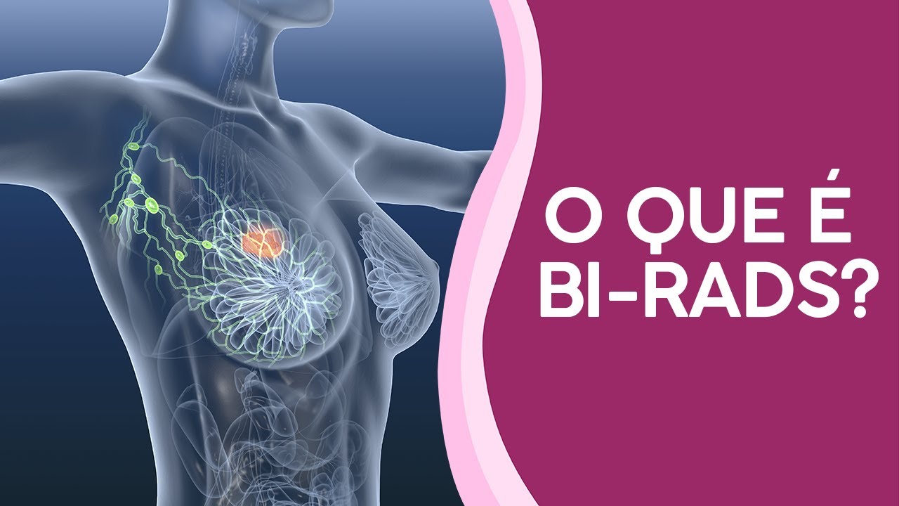 O que é BI-RADS?