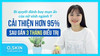 Ngọc Hân: Làn da sạch mụn ẩn với Scar LAB