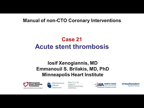 Case 21: PCI Manual - Acute stent thrombosis