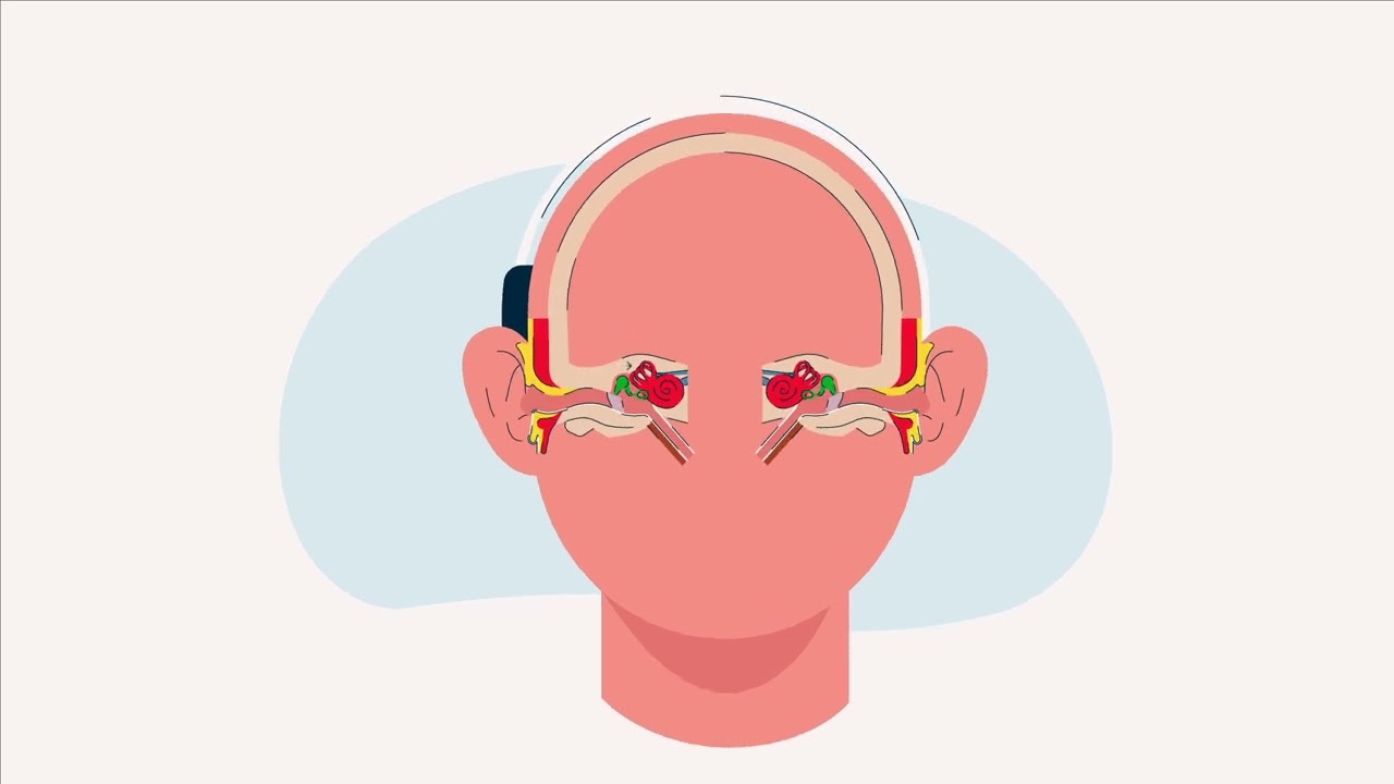 What Is An Audiogram?