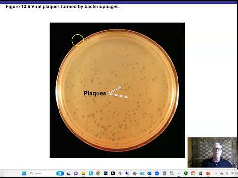 Ch 13 Part 1 Viruses and Prions