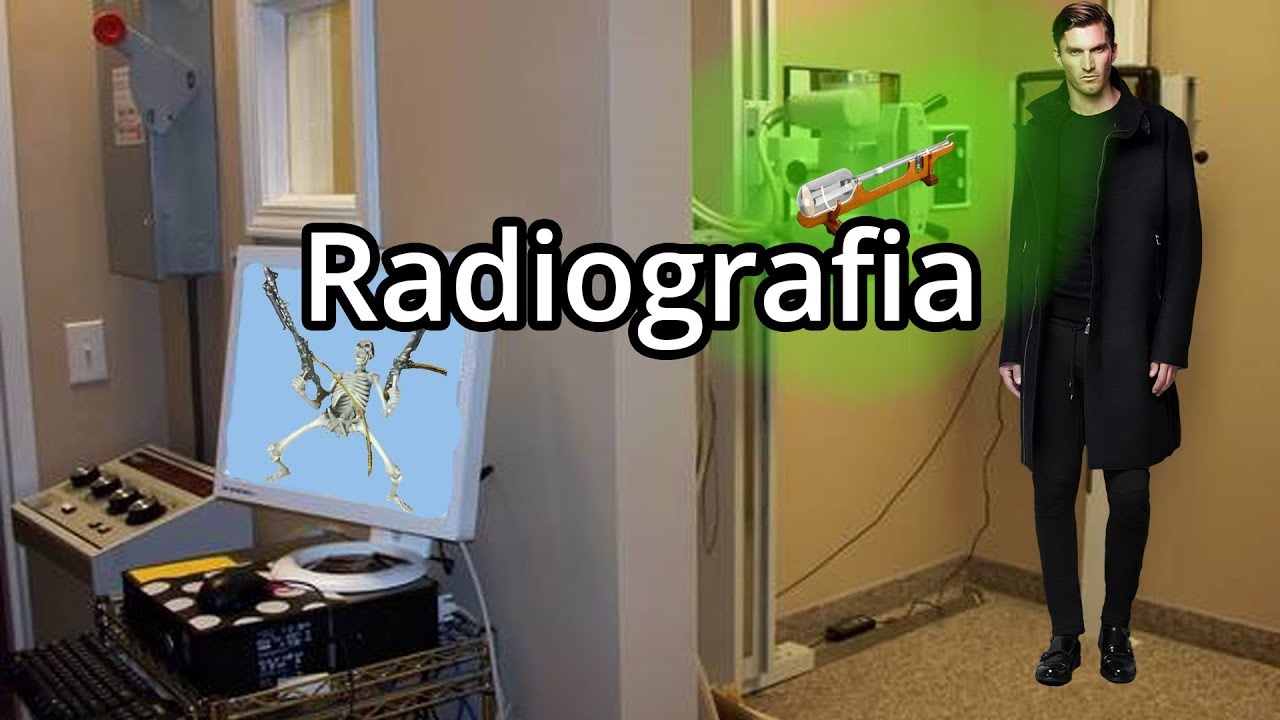 Watch Now Alla scoperta della RADIOGRAFIA e dei RAGGI X adesso - Spiegazione Alla scoperta della RADIOGRAFIA e dei RAGGI X adesso - Spiegazione