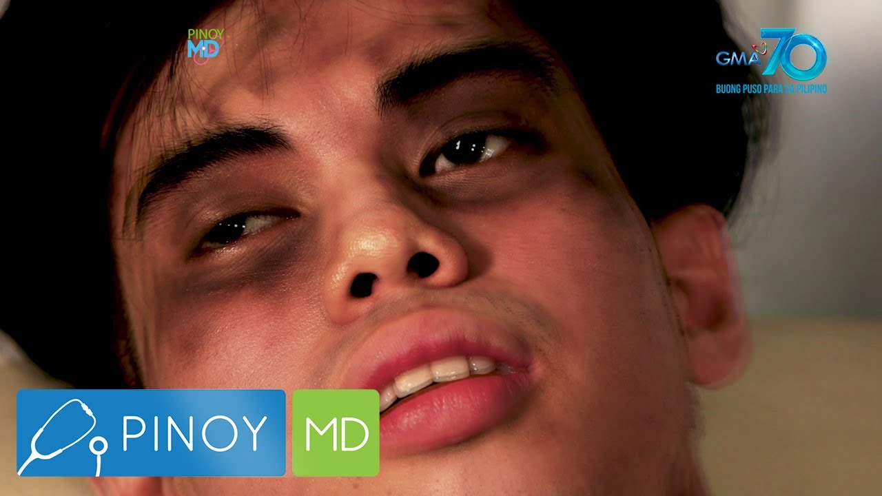 Putar video Pinoy MD: Ano ba ang masamang epekto ng kakulangan sa tulog at paano ito maiiwasan sekarang Pinoy MD: Ano ba ang masamang epekto ng kakulangan sa tulog at paano ito maiiwasan