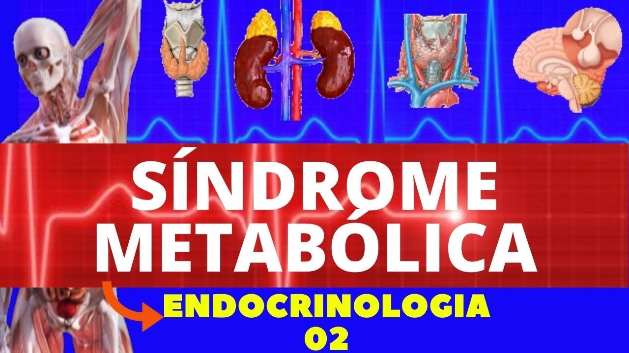 SÍNDROME METABÓLICA (RESISTÊNCIA A INSULINA) - ENDOCRINOLOGIA