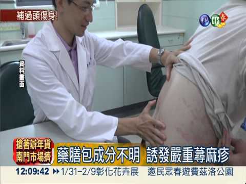 藥膳包煮火鍋 1家3代蕁麻疹