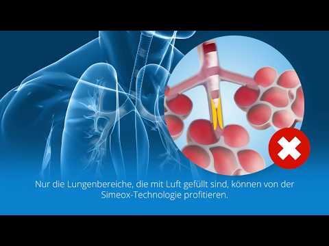 Sekretmobilisation mit Simeox - PhysioAssist - DE