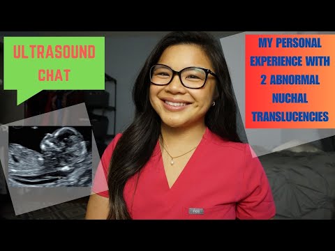 My Personal Experience with 2 ABNORMAL Nuchal Translucencies