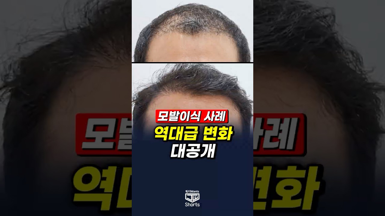 더원츠의원 숏폼