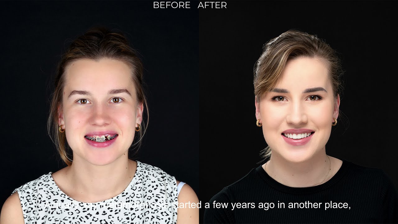 Metamorfoza uśmiechu Patrycji