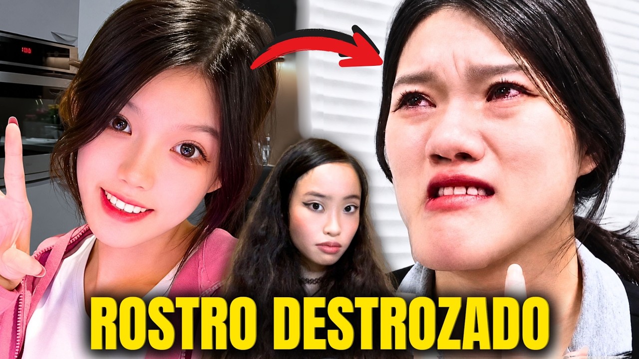 Fue a corregir 2 MILÍMETROS… y ARRUINARON EL ROSTRO DE ESA INFLUENCER "A PROPÓSITO"