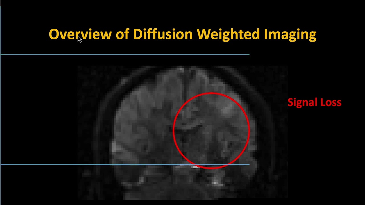 Using Neurodesk to Analyze Diffusion Data with TBSS