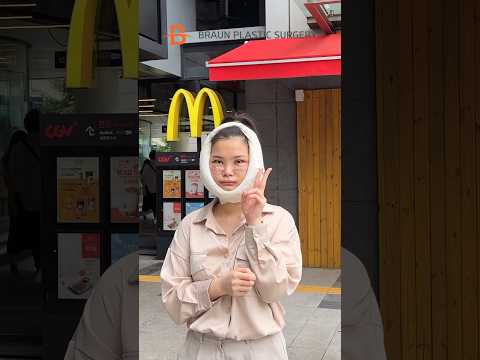 Looking so much younger after surgery🧡✨💀👁️ #plasticsurgery  #beforeandafter #transformation