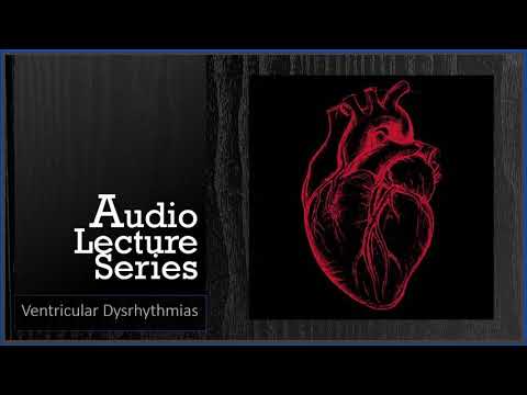 13 Ventricular Dysrhythmias