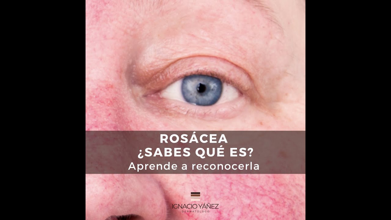 Ignacio Yáñez Silva-3