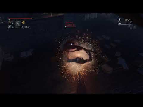 The moment I realized that I hated the amygdala arm