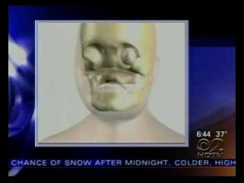 Sundeep Kaur Severed Face