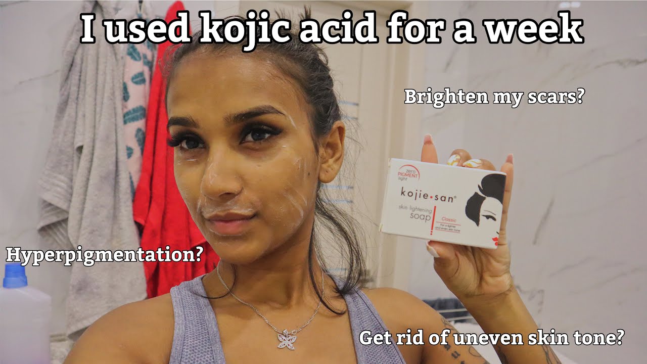 I Used Kojic Acid For A Week & This Happened || Kojie San Review
