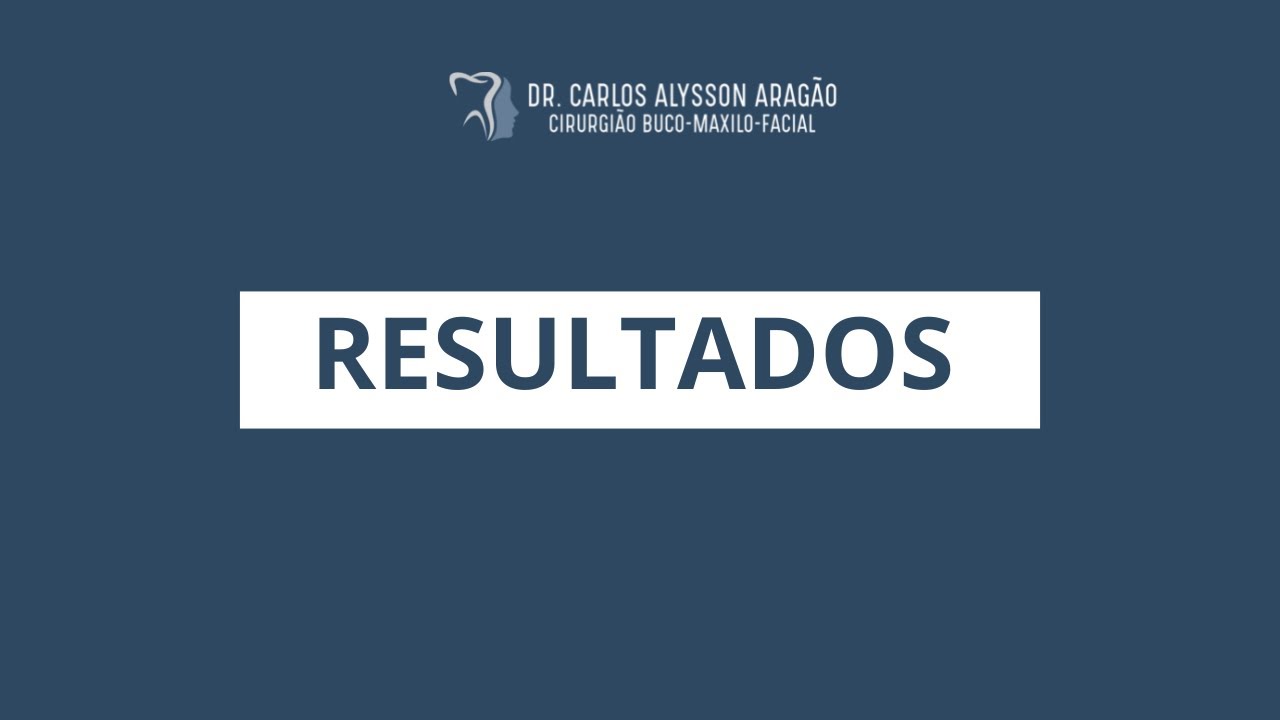 Carlos Alysson Aragão-47