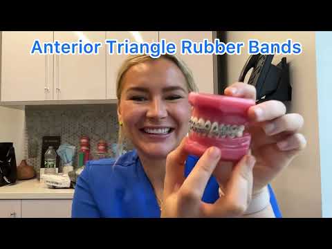 How to Wear Rubber Bands! Episode 1