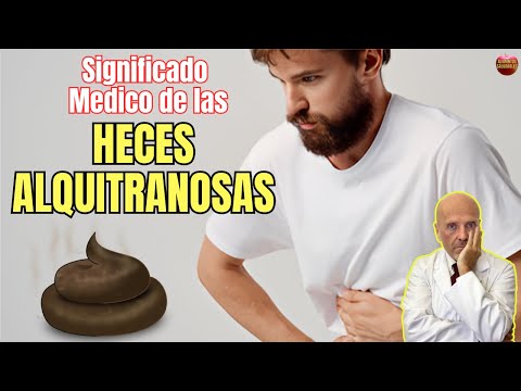 🆘 SIGNIFICADO DE LAS HECES ALQUITRANOSAS O MELENAS ¿QUE HACER SI TIENES HECES MUY NEGRAS? 🆘