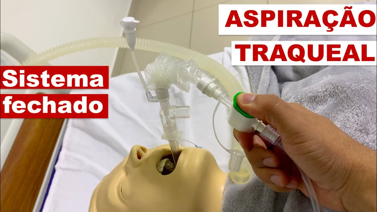 ASPIRAÇÃO TRAQUEAL COM SISTEMA FECHADO