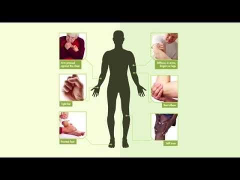 Spasticity Informational Video