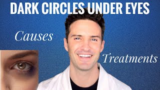 Dark Circles Under Eyes: Causes & Treatments