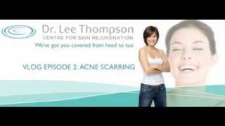 Dr. Lee Thompson - Vlog: Acne Scarring