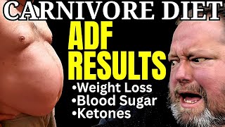 Alternate Day Fasting: 10 Day Results With No Dairy