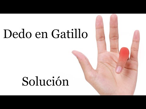 Dedo en Gatillo o Resorte Solución Rutina de Maniobras