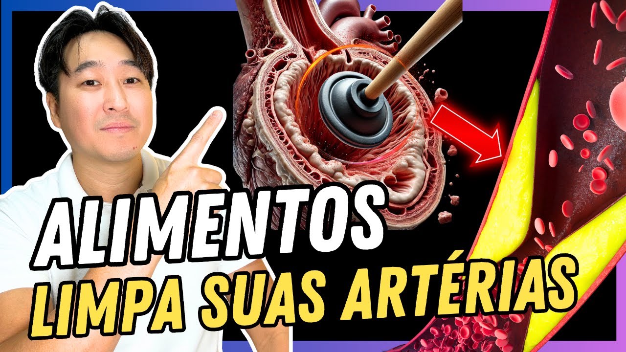 COMO LIMPAR SUAS ARTÉRIAS NATURALMENTE? ALIMENTOS, SUPLEMENTOS.