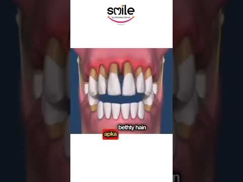 Professional teeth whitening treatment at Alkhaleej Smile Clinic Karachi