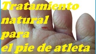 ELIMINAR LOS HONGOS EN LOS PIES. Eliminate the FUNGI IN THE FEET.