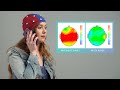 Aires Tech EEG Brain Scan Demonstration | EMF effects on the brain