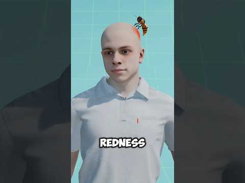 Why YELLOW Wasp Sting Hurt So Bad? 😨