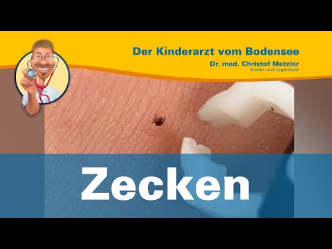 Zecken — Der Kinderarzt vom Bodensee