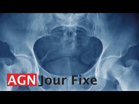 Jour Fixe: Das Wirbelsäulentrauma