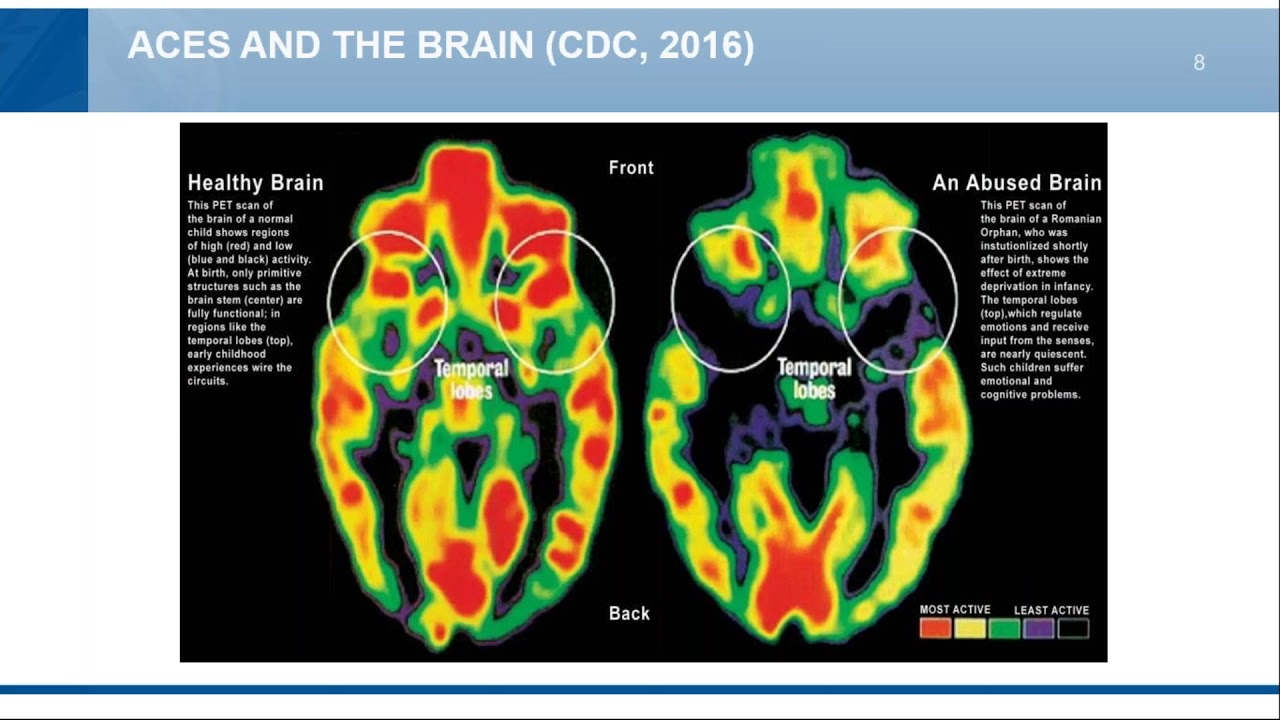 The Buffering Role of Community Resilience Against Adverse Childhood Experiences