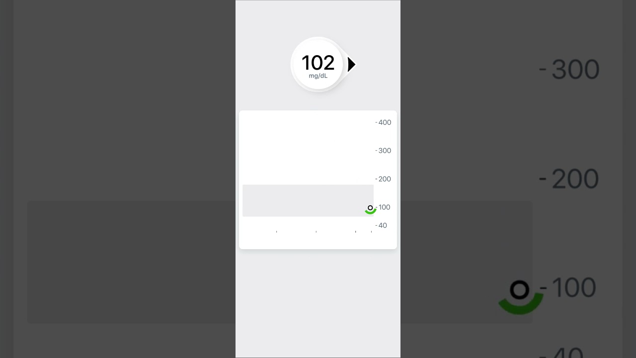 IAV overview Dexcom ONE+ OUS EL MGDL