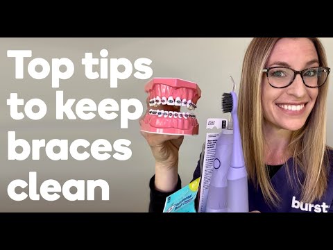 Top oral care tips while you're in braces