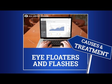 Eye Floaters Explained