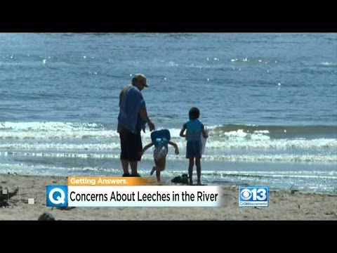 Leeches In California
