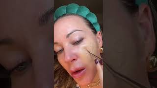 Download lagu WHY THE BEST PIMPLE PATCH IS THE ONE YOU CANNOT FIND mp3