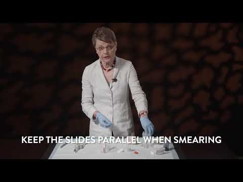 Fine Needle Aspiration Biopsy (FNA) Techniques - Dividing & Smearing Technique