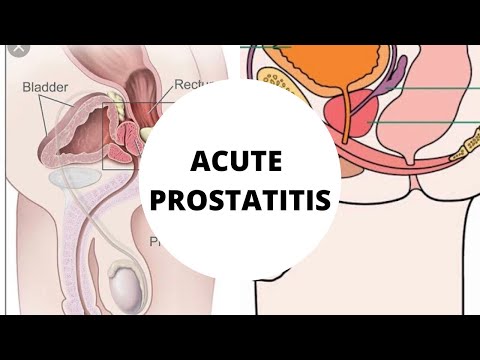 Acute bacterial prostatitis etiology